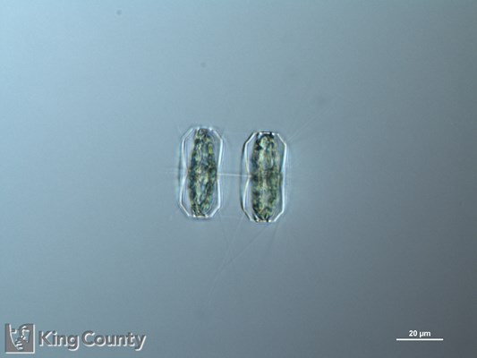 Photo of Thalassiosira nordenskioeldii